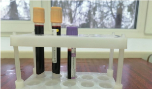 С 2026 года в Самарской области вводят обязательную проверку мигрантов на гепатит С 2026 года в Самарской области вводят обязательную проверку мигрантов на гепатит